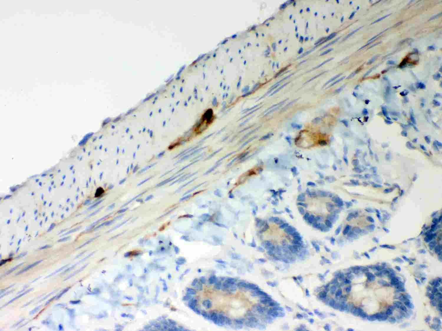 2 - Anti-ATP5H Picoband Antibody ABO12019