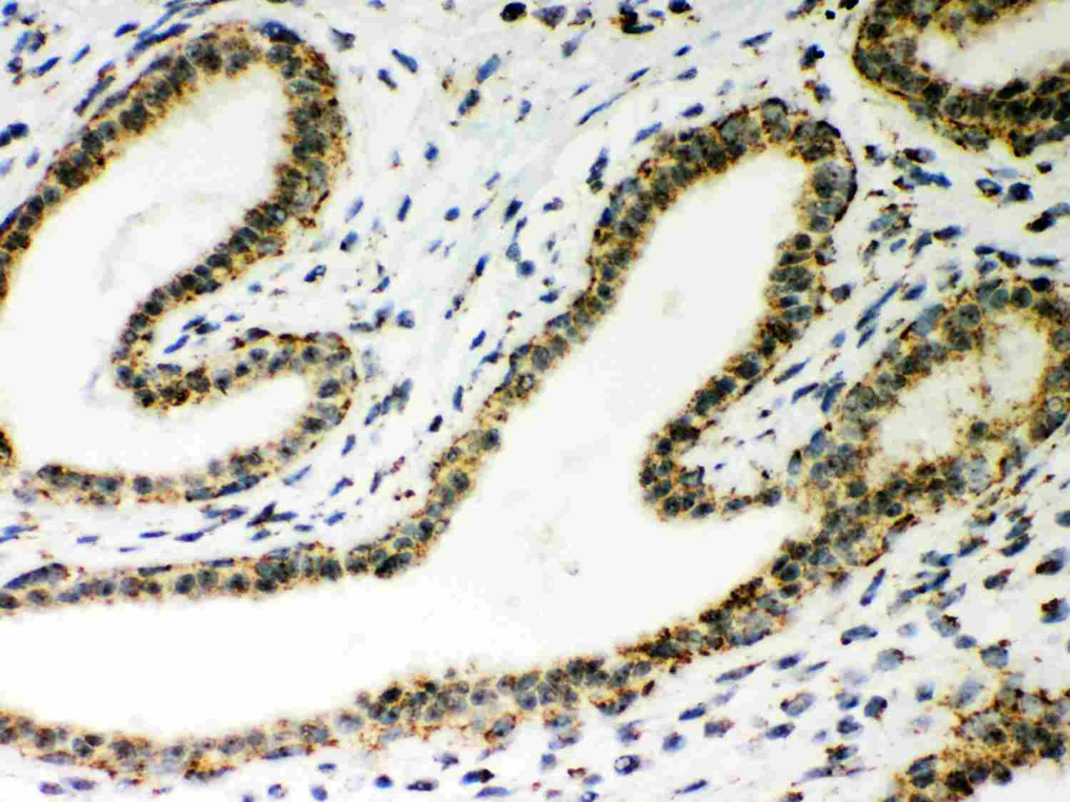 2 - Anti-ATP5H Picoband Antibody ABO12019