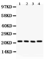 1 - Anti-ATP5H Picoband Antibody ABO12019