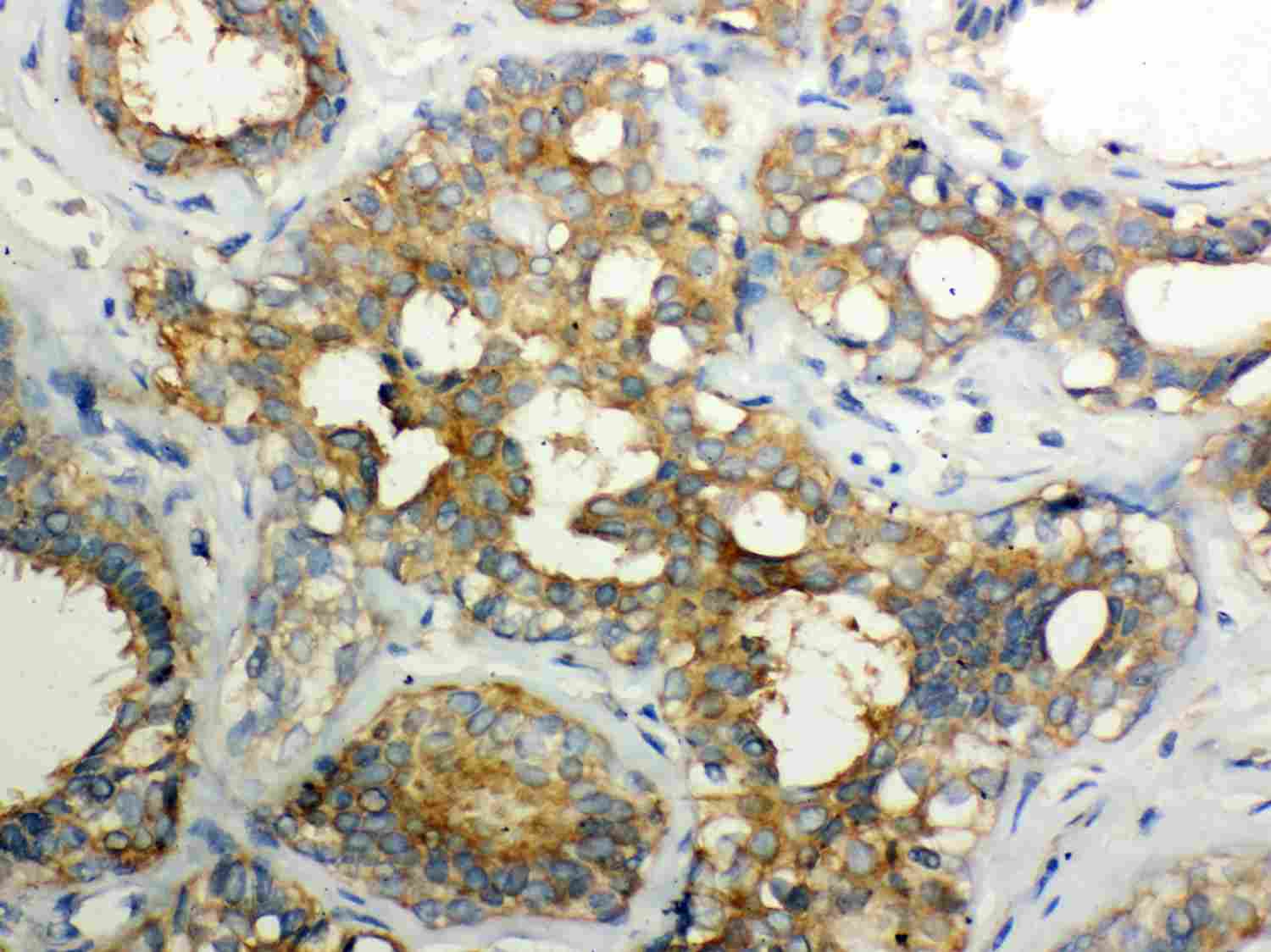2 - Anti-Calpain 1 Picoband Antibody ABO12021