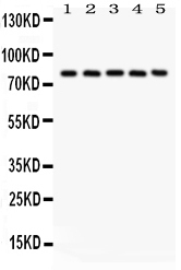 1 - Anti-Calpain 1 Picoband Antibody ABO12021