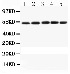 1 - Anti-Caspase 8 Antibody ABO12022