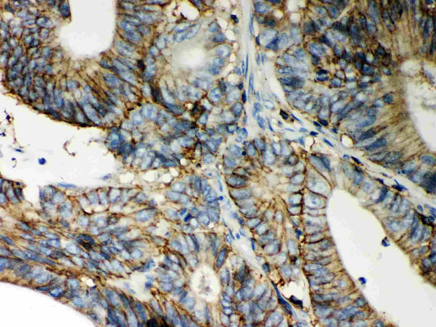 2 - Anti-CD44 Picoband Antibody ABO12024