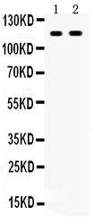 1 - Anti-CD44 Picoband Antibody ABO12024