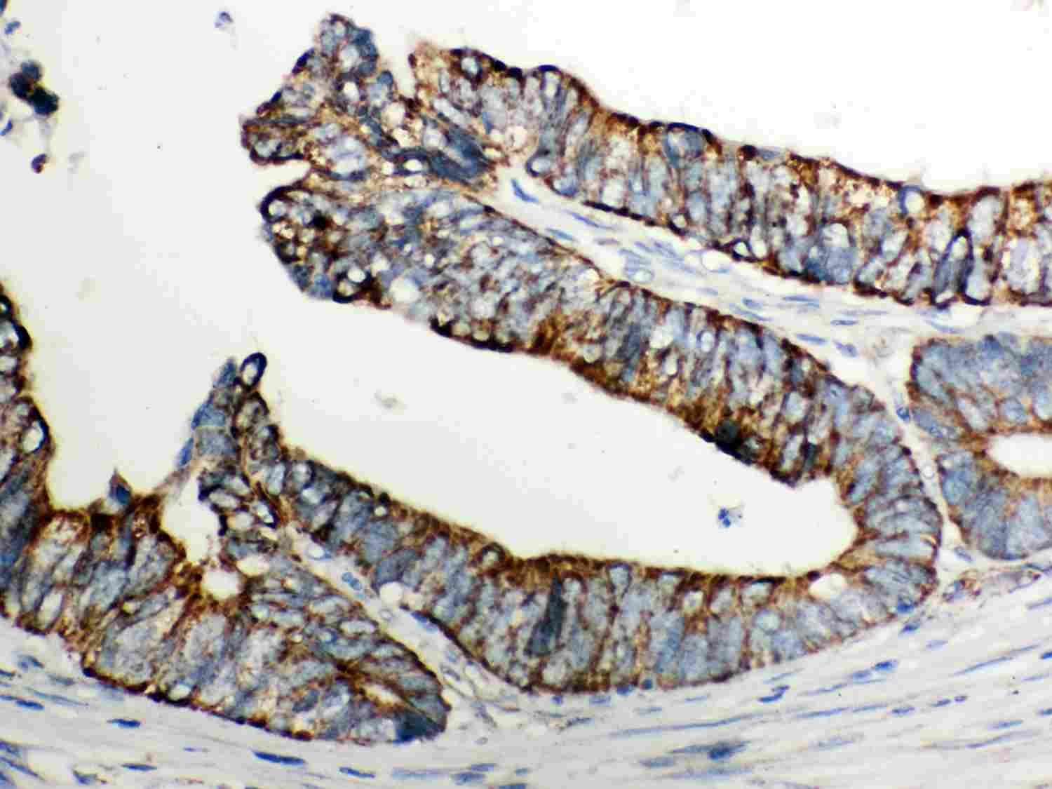 2 - Anti-Cytochrome C Picoband Antibody ABO12025