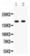 1 - Anti-NMDAR2A Picoband Antibody ABO12026