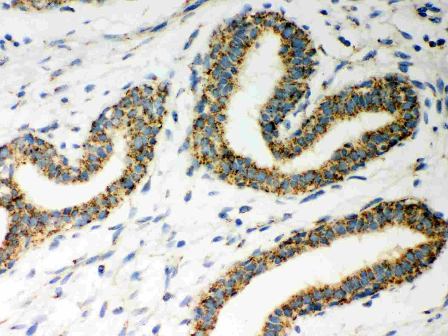 2 - Anti-ERAB Antibody Antibody ABO12027