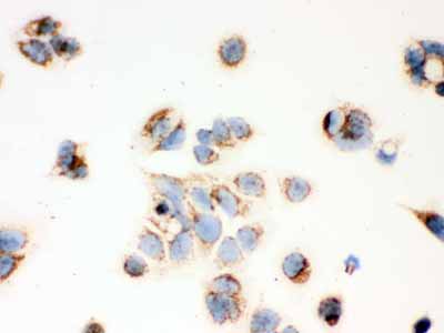 2 - Anti-ERAB Antibody Antibody ABO12027