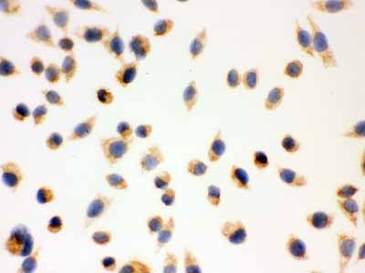 2 - Anti-ERAB Antibody Antibody ABO12027