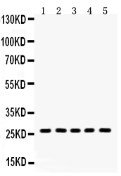 1 - Anti-ERAB Antibody Antibody ABO12027