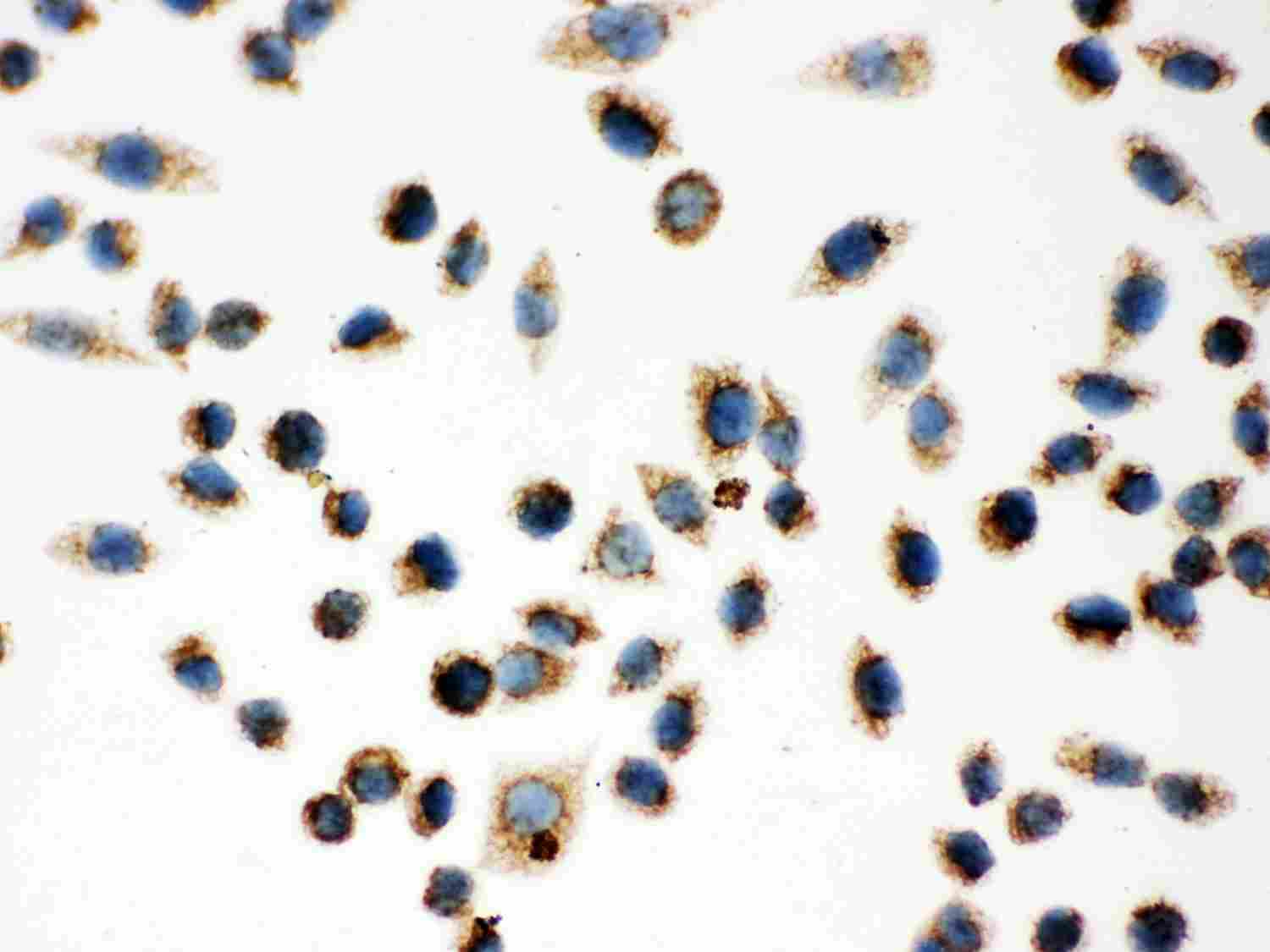 8 - Anti-Hsp60 Picoband Antibody ABO12028