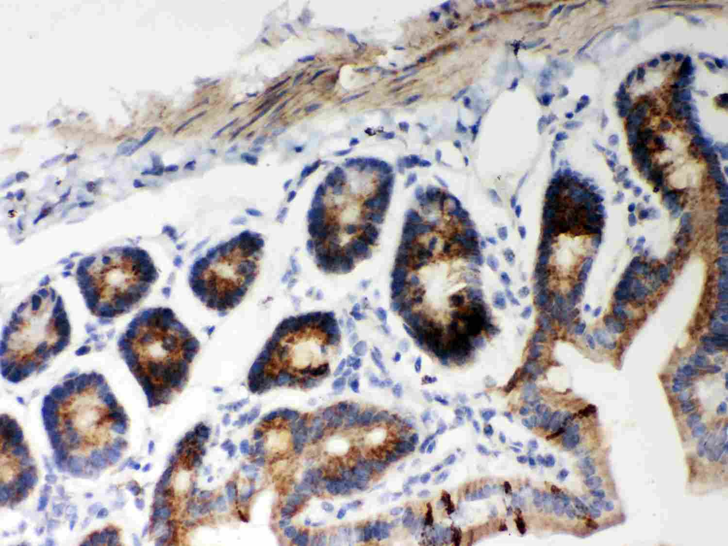 2 - Anti-Hsp60 Picoband Antibody ABO12028