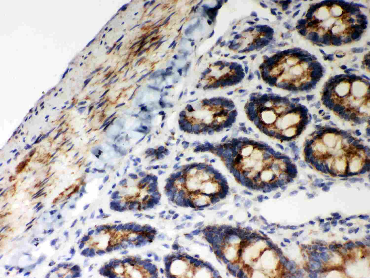 2 - Anti-Hsp60 Picoband Antibody ABO12028