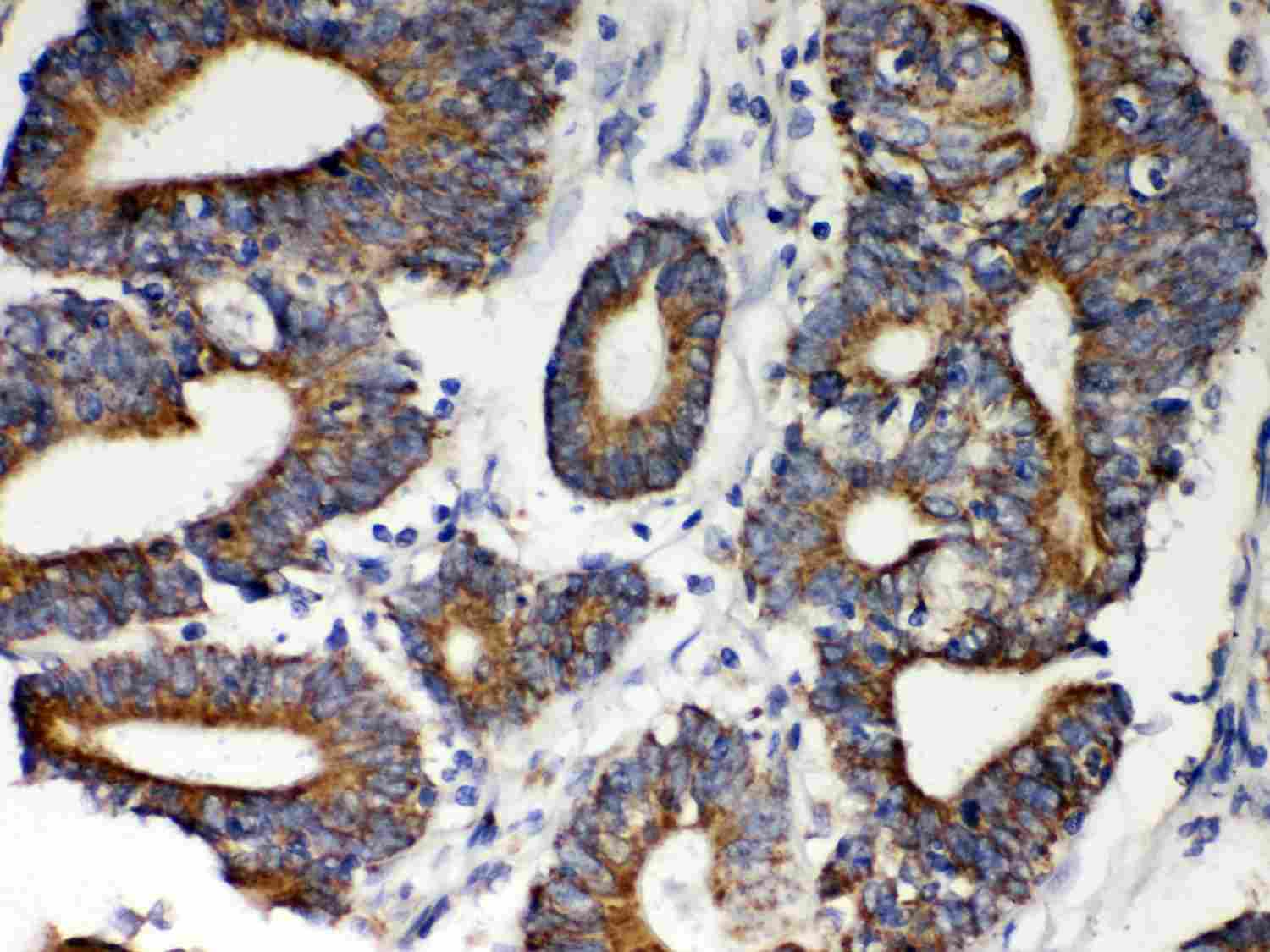 2 - Anti-Hsp60 Picoband Antibody ABO12028