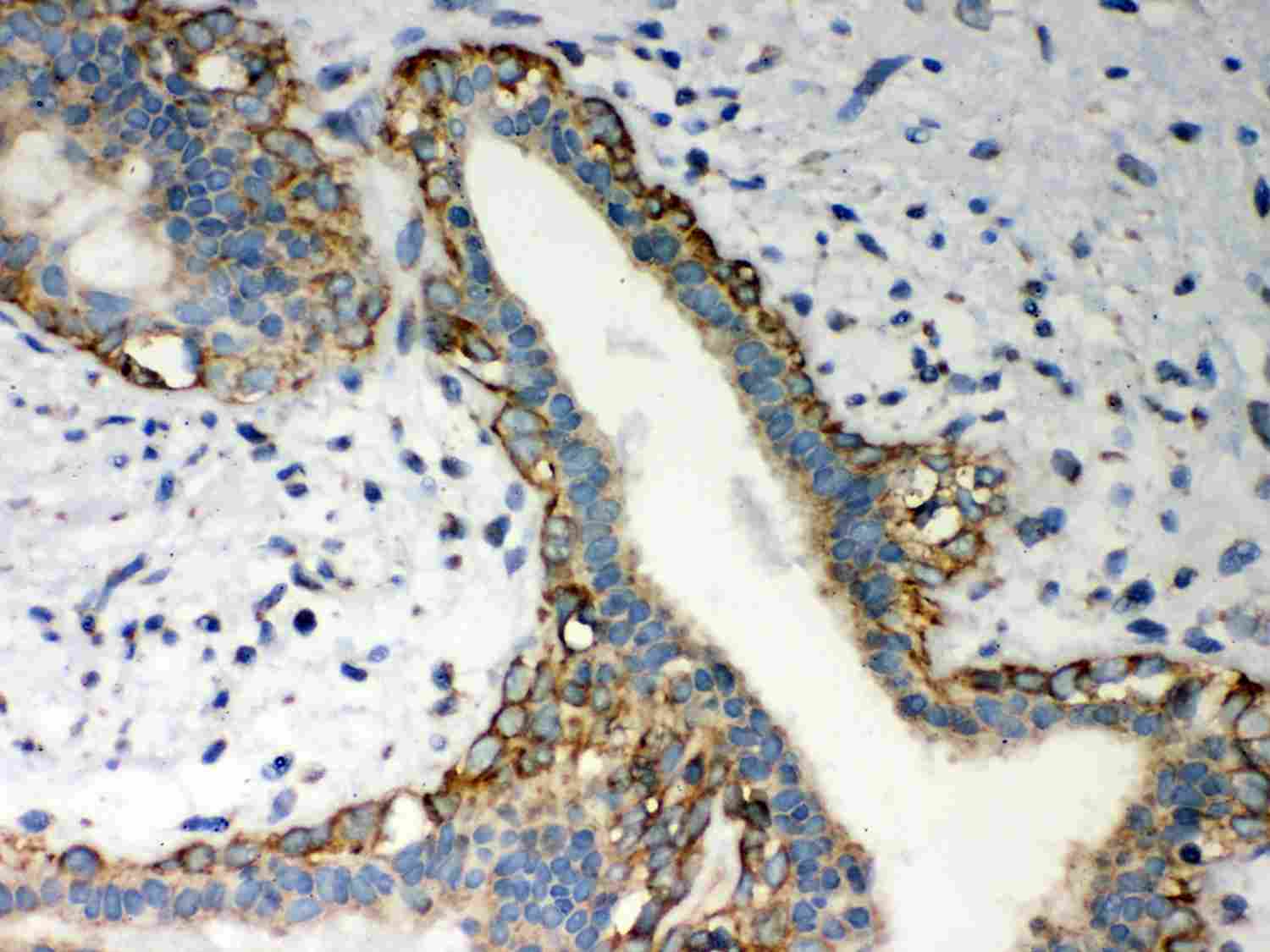 2 - Anti-LYRIC Picoband Antibody ABO12029