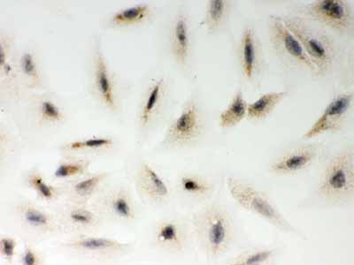 2 - Anti-LYRIC Picoband Antibody ABO12029