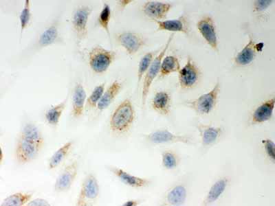 2 - Anti-LYRIC Picoband Antibody ABO12029