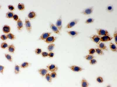 2 - Anti-LYRIC Picoband Antibody ABO12029