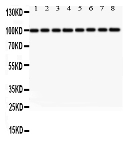 1 - Anti-LYRIC Picoband Antibody ABO12029