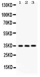 1 - Anti-NMI Picoband Antibody ABO12031