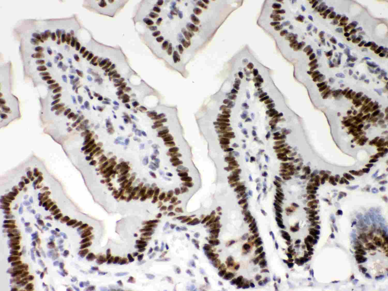 2 - Anti-Nucleophosmin Picoband Antibody ABO12032