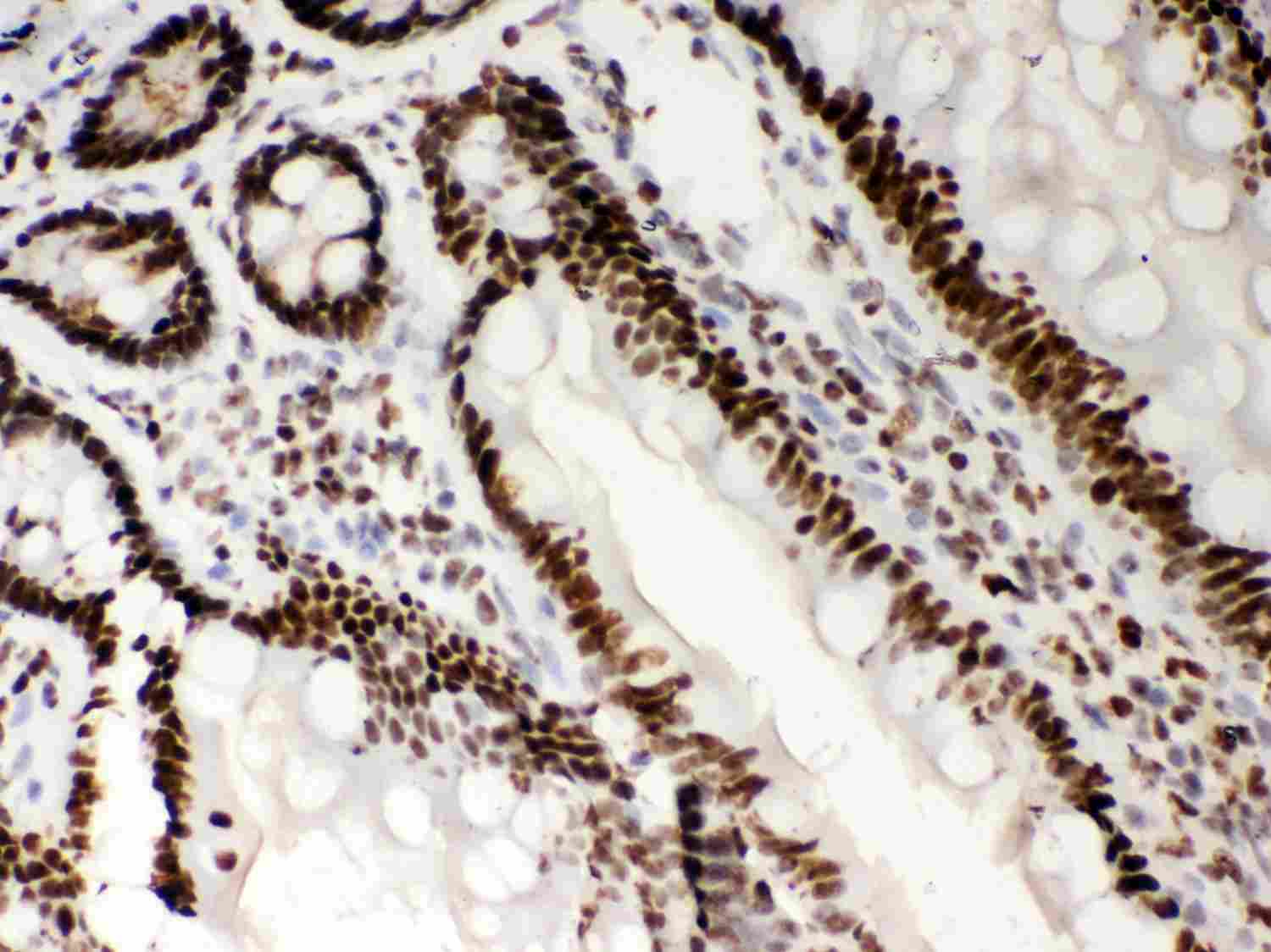 2 - Anti-Nucleophosmin Picoband Antibody ABO12032
