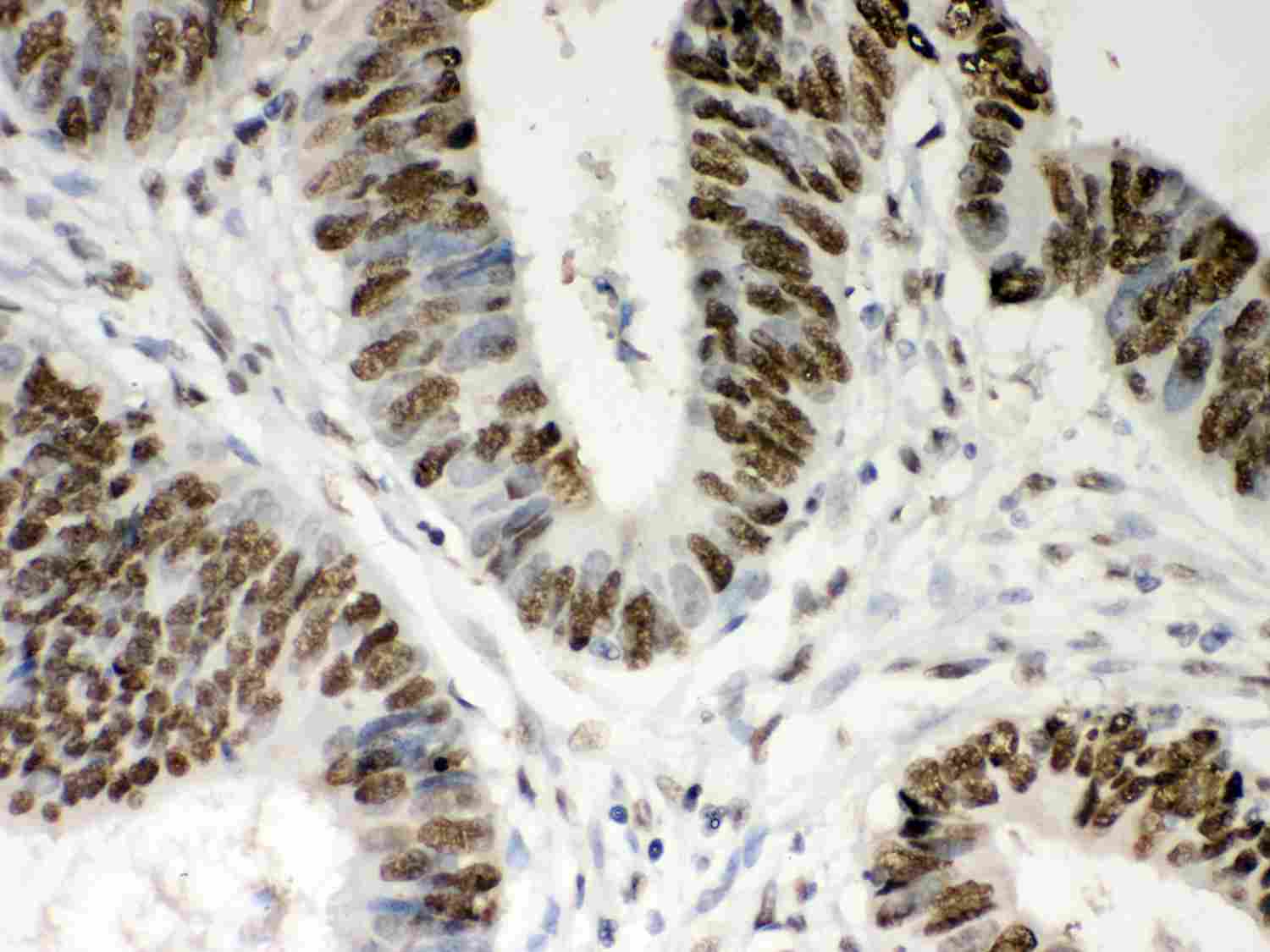 2 - Anti-Nucleophosmin Picoband Antibody ABO12032