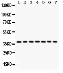1 - Anti-Nucleophosmin Picoband Antibody ABO12032