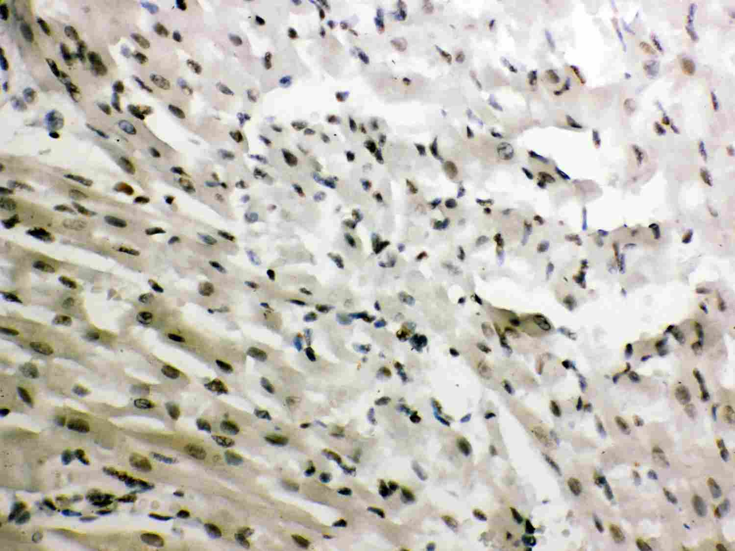 2 - Anti-NR3C1 Picoband Antibody ABO12033