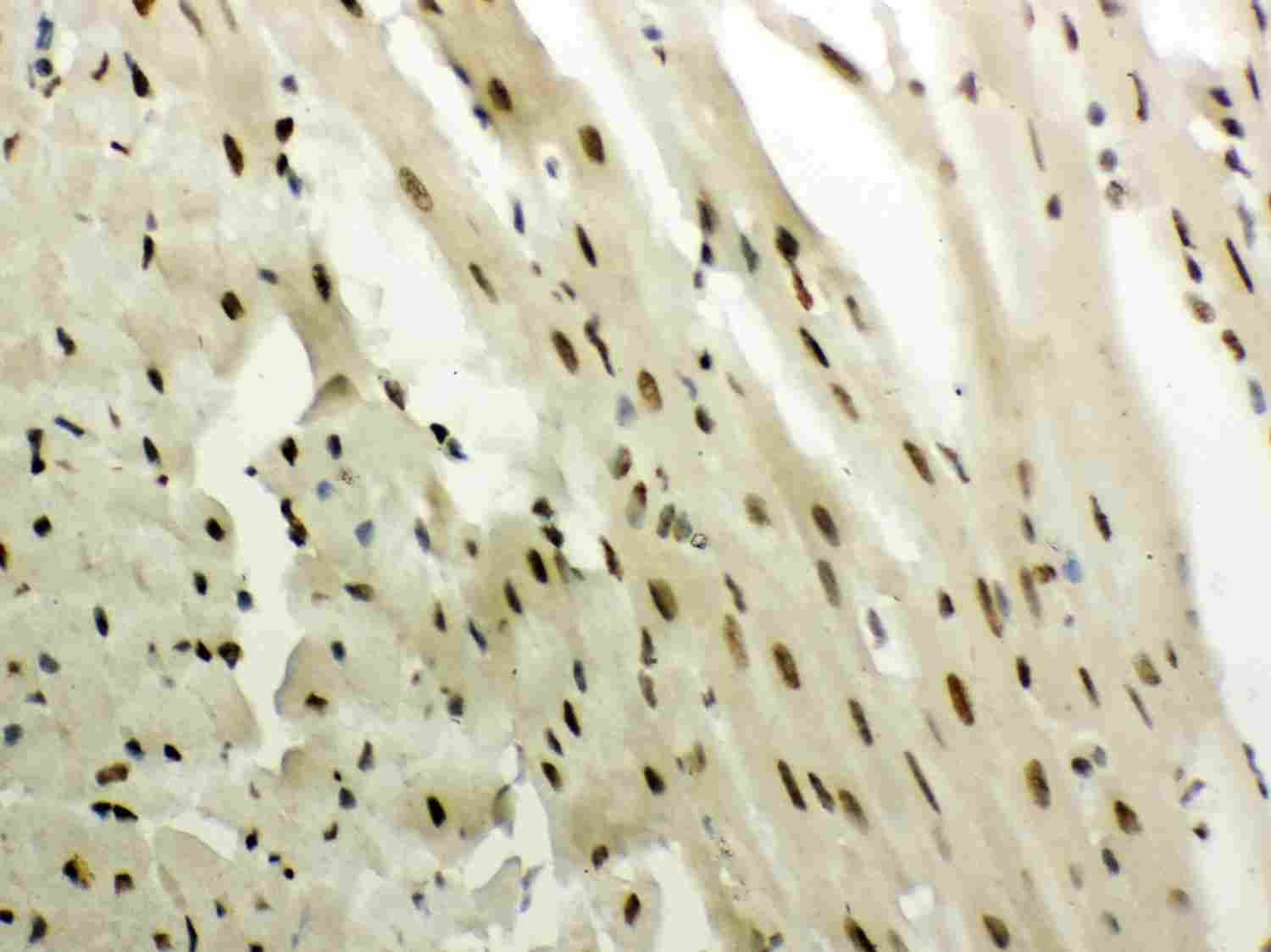 2 - Anti-NR3C1 Picoband Antibody ABO12033