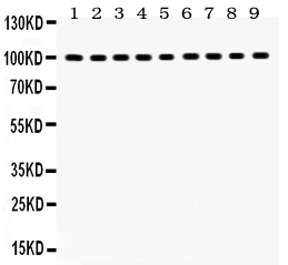 1 - Anti-NR3C1 Picoband Antibody ABO12033