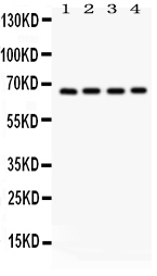 1 - Anti-Optineurin Picoband Antibody ABO12034