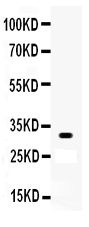 1 - Anti-Otx2 Picoband Antibody ABO12035