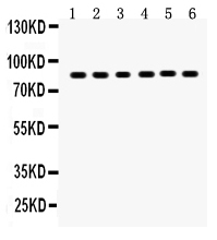 1 - Anti-PLAT/TPA Antibody ABO12036