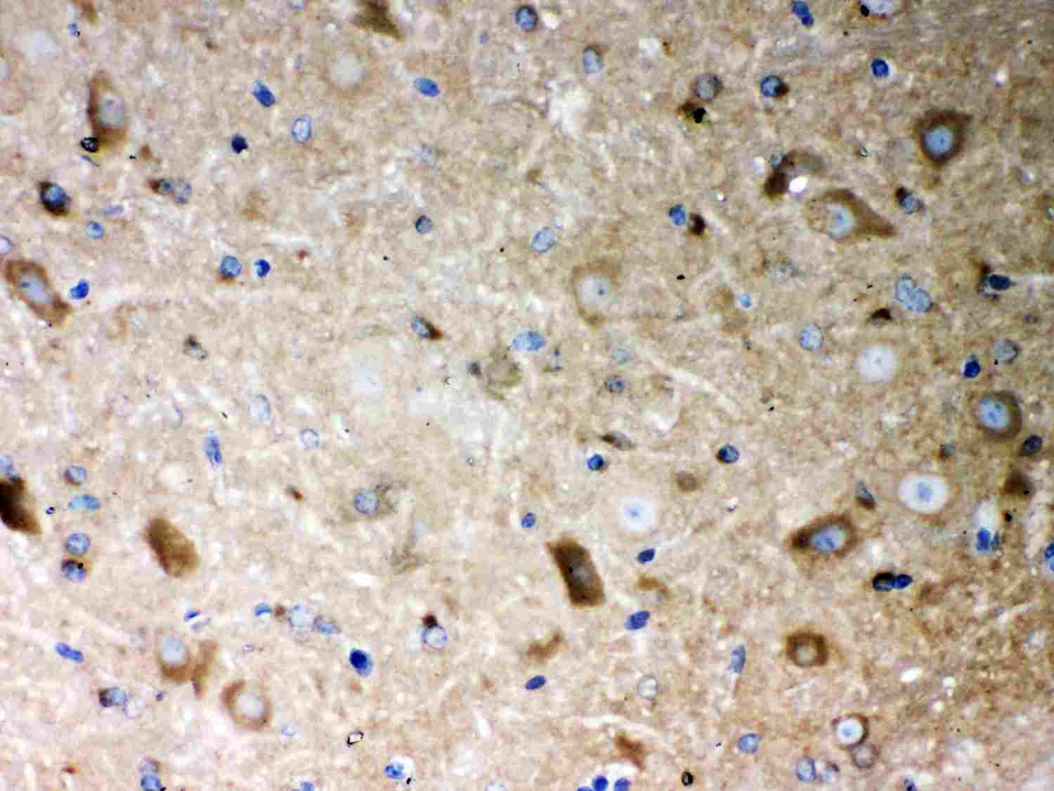 2 - Anti-PP2A-Alpha Picoband Antibody ABO12038