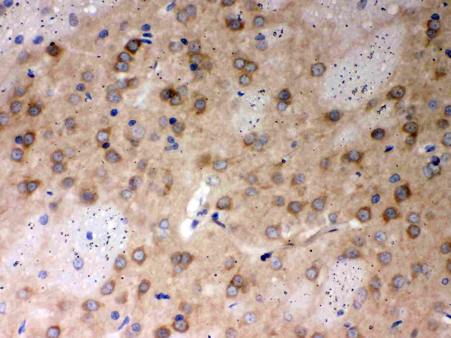 2 - Anti-PP2A-Alpha Picoband Antibody ABO12038