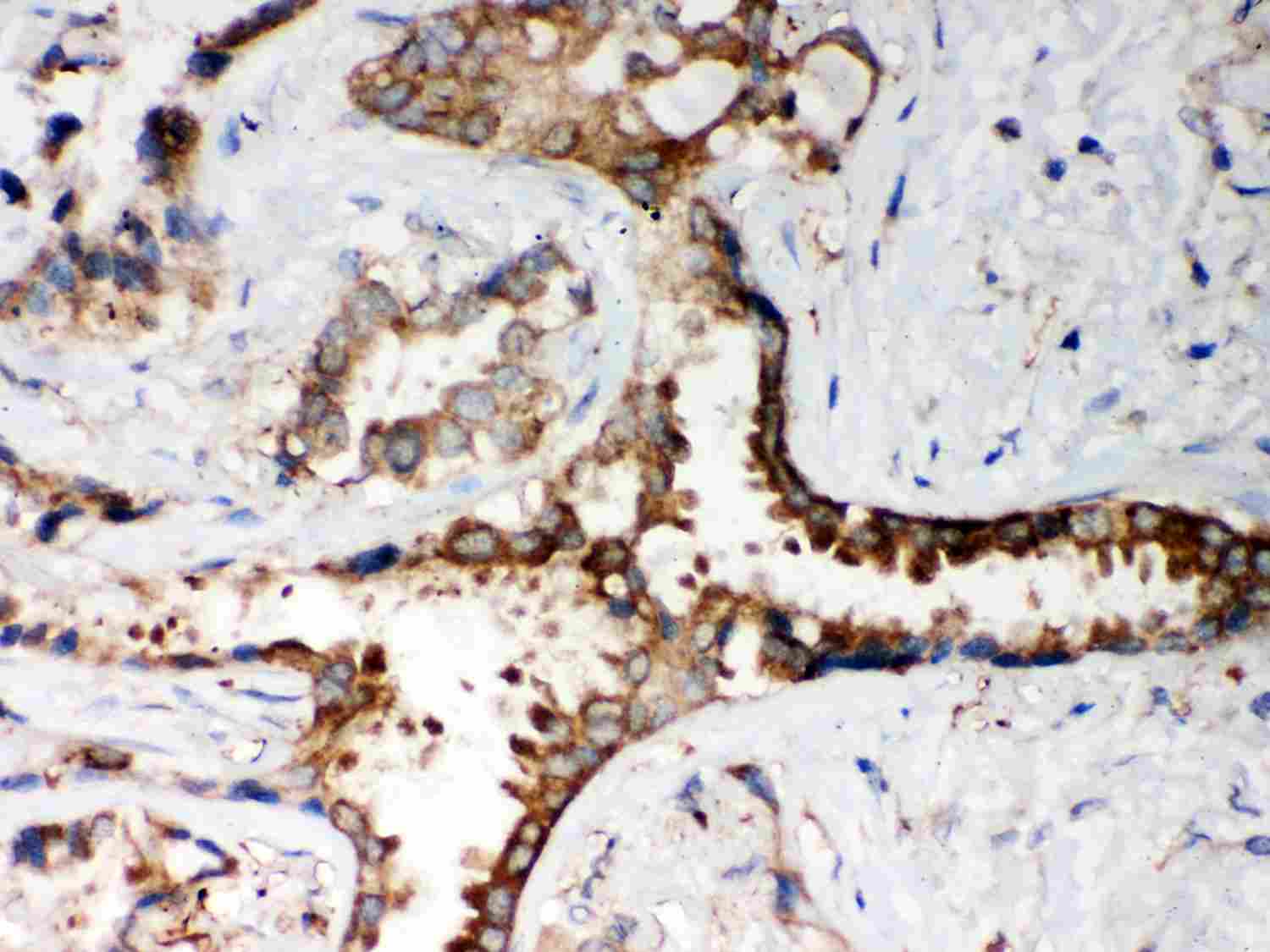 2 - Anti-PP2A-Alpha Picoband Antibody ABO12038