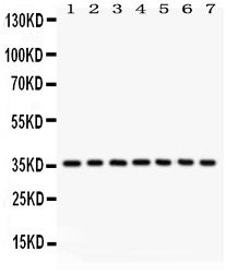 1 - Anti-PP2A-Alpha Picoband Antibody ABO12038