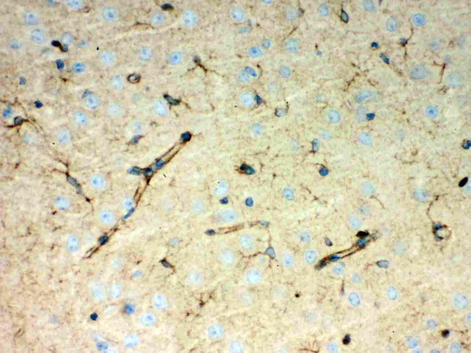 2 - Anti-Peroxiredoxin 1 Picoband Antibody ABO12039