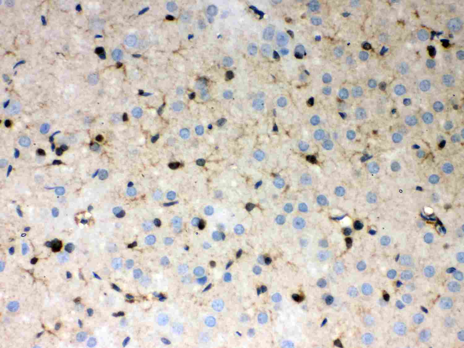 2 - Anti-Peroxiredoxin 1 Picoband Antibody ABO12039