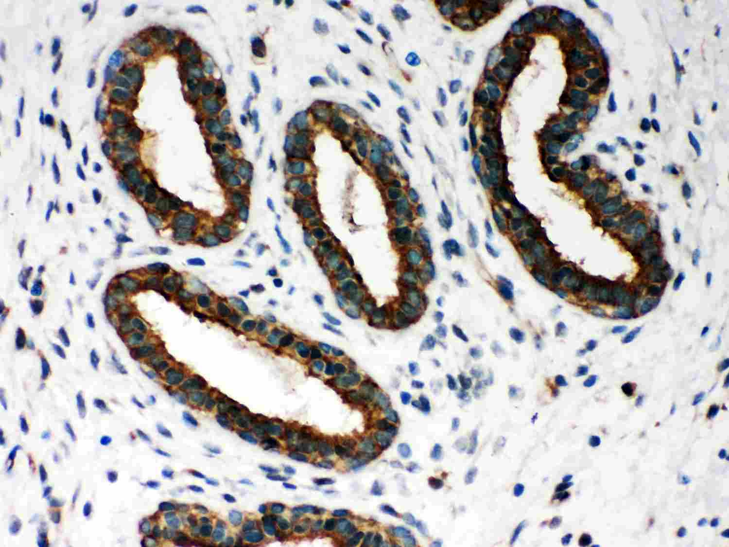 2 - Anti-Peroxiredoxin 1 Picoband Antibody ABO12039