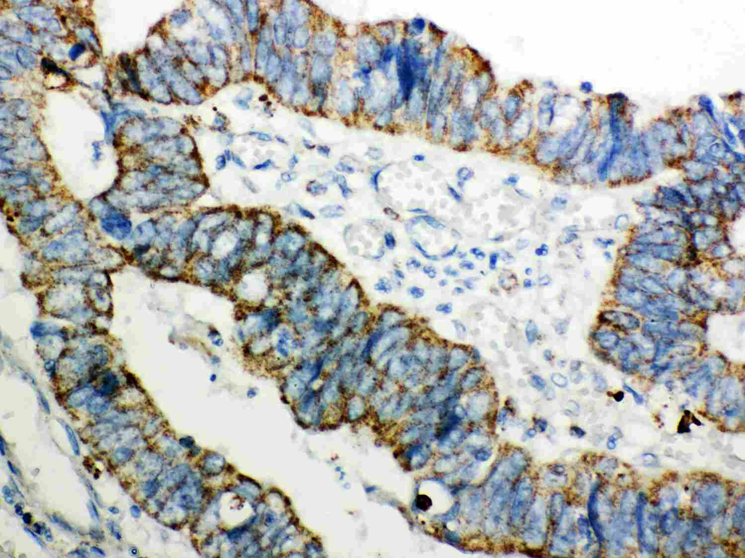 2 - Anti-Peroxiredoxin 3 Picoband Antibody ABO12040