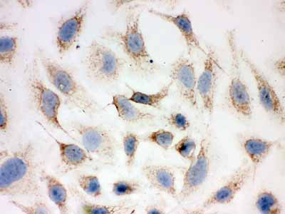2 - Anti-Peroxiredoxin 3 Picoband Antibody ABO12040