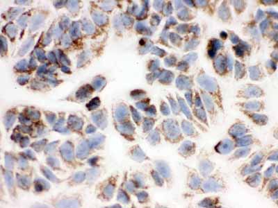 2 - Anti-Peroxiredoxin 3 Picoband Antibody ABO12040