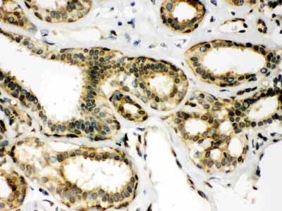 2 - Anti-Peroxiredoxin 6 Picoband Antibody ABO12041