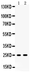 1 - Anti-Peroxiredoxin 6 Picoband Antibody ABO12041