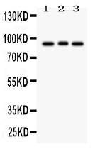 1 - Anti-Semaphorin 3A Picoband Antibody ABO12044