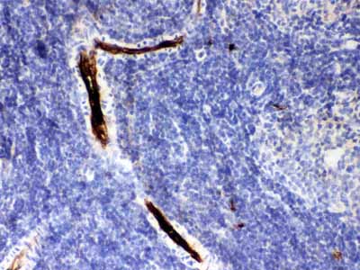 2 - Anti-SERPINA1 Picoband Antibody ABO12045