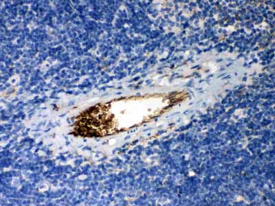 2 - Anti-SERPINA1 Picoband Antibody ABO12045