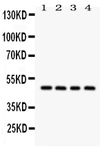1 - Anti-SERPINA1 Picoband Antibody ABO12045